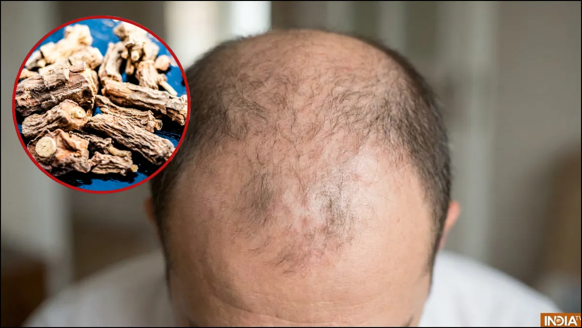 बाल झड़ने और गंजेपन में फायदेमंद है अनंतमूल? जानें उपयोग